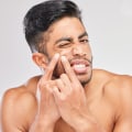 Common Skin Concerns in Men